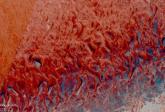 Blutwürmer, Oman